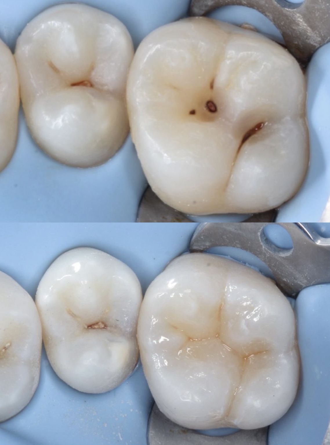 toxina botulinica santiago 