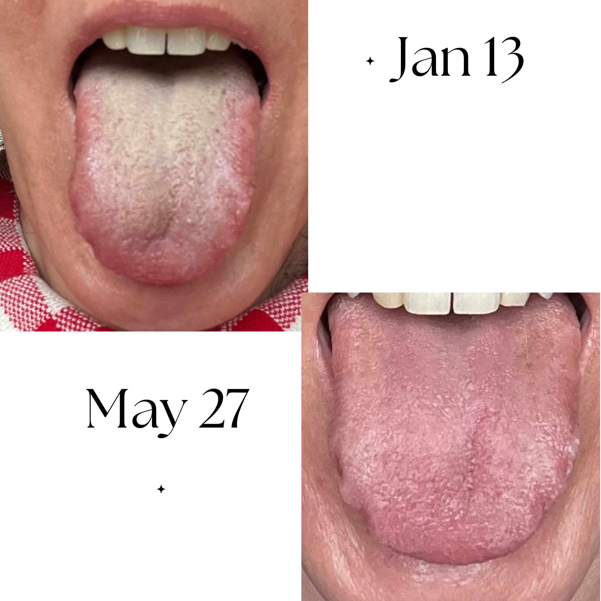 Tongue comparison 1: Jan 13 - May 27