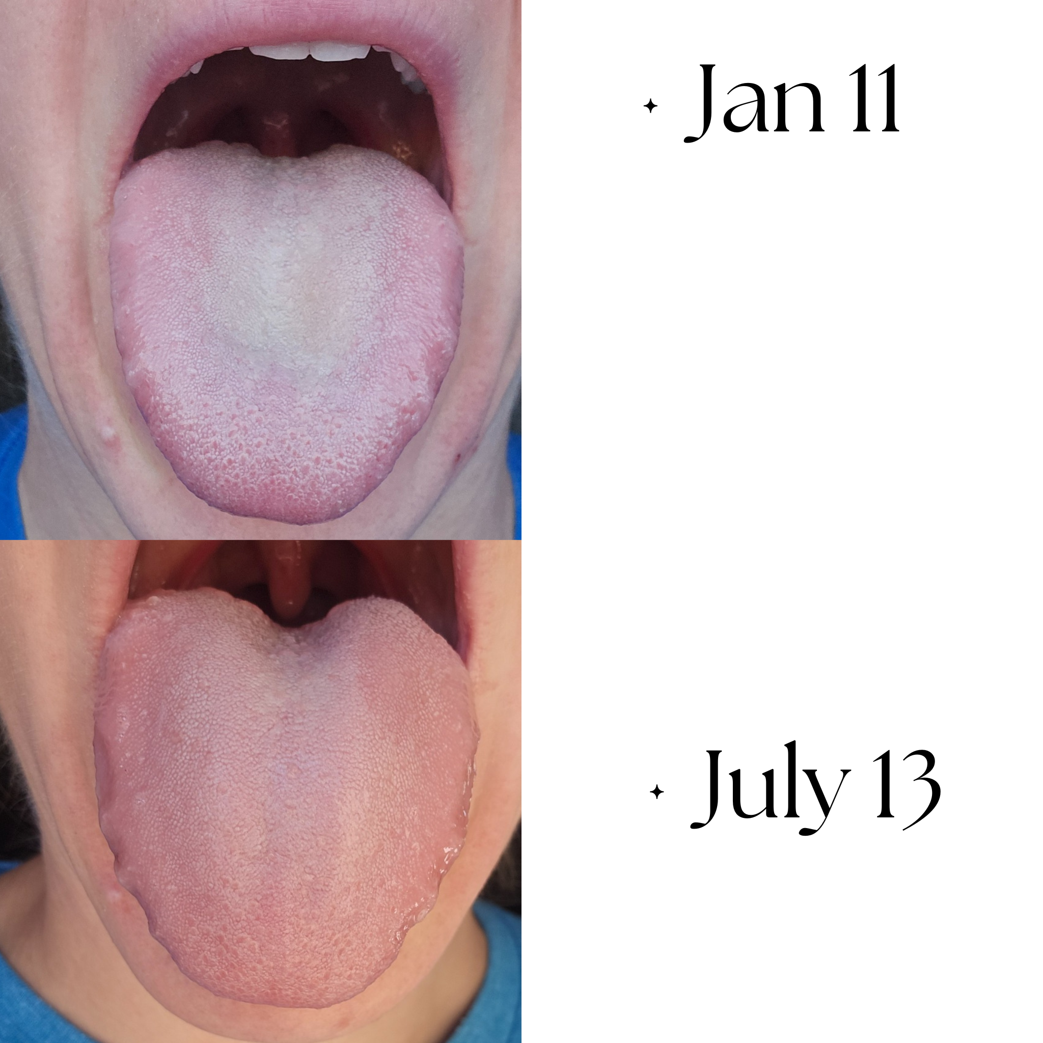Tongue comparison 2: Jan 11 - July 13