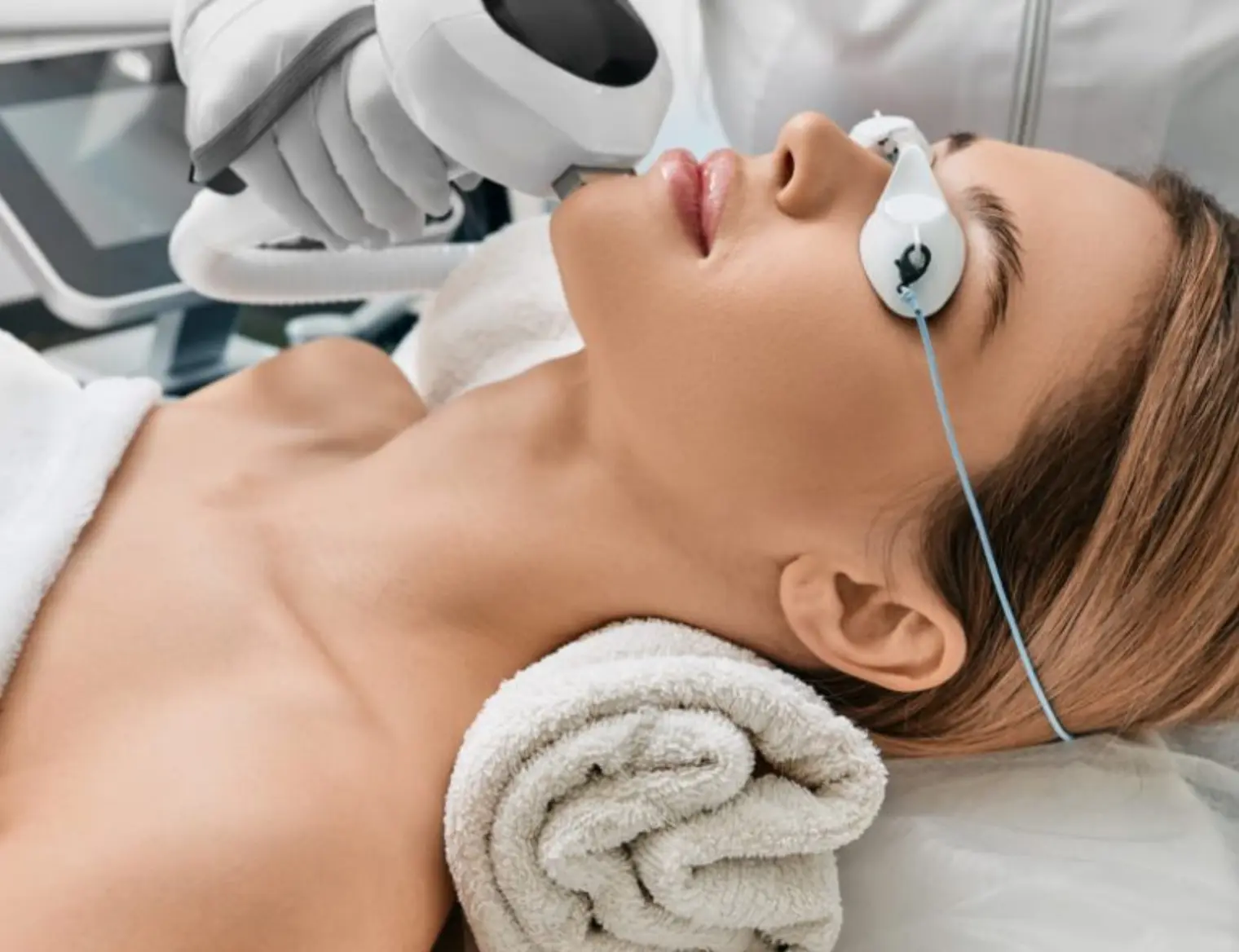 IPL Photofacial