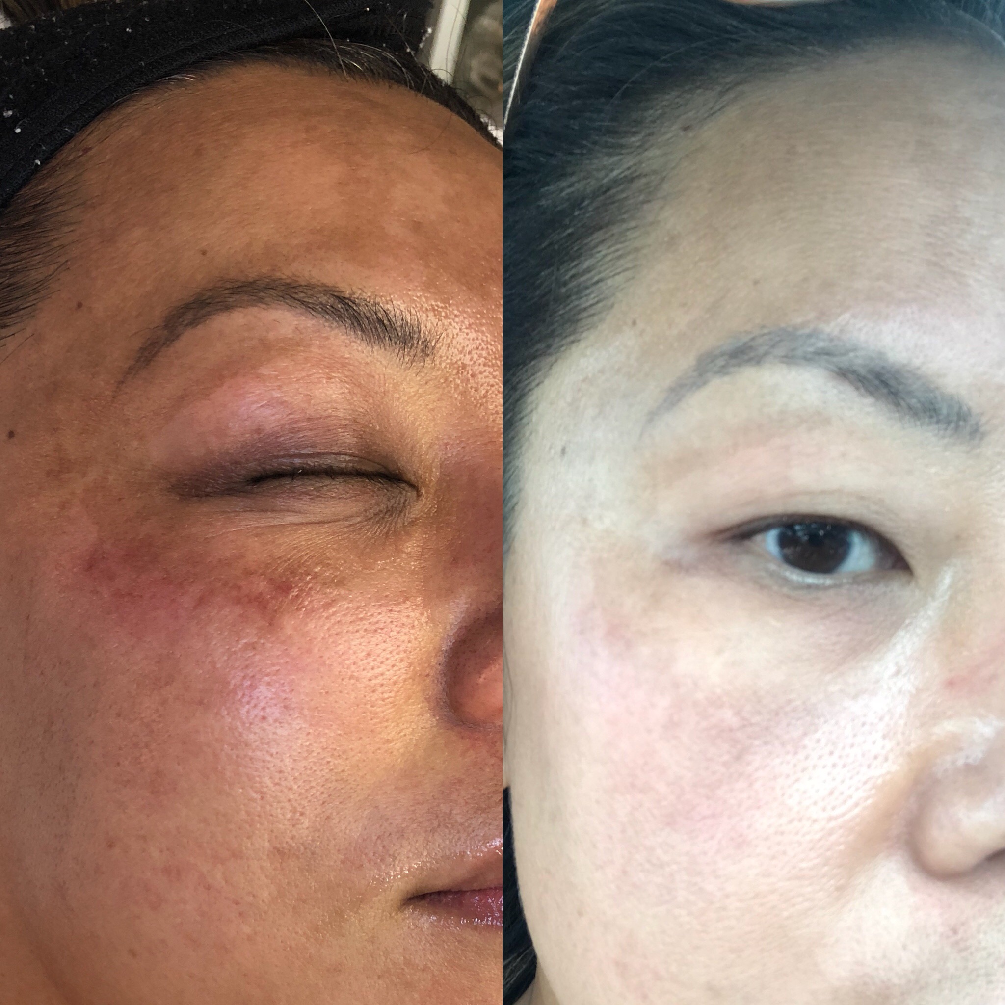 Skin Bar Signature Facial