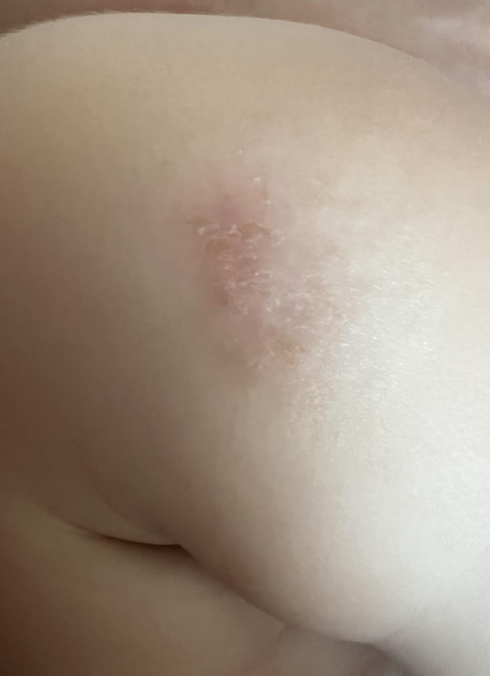 Mateo after the gut-first method