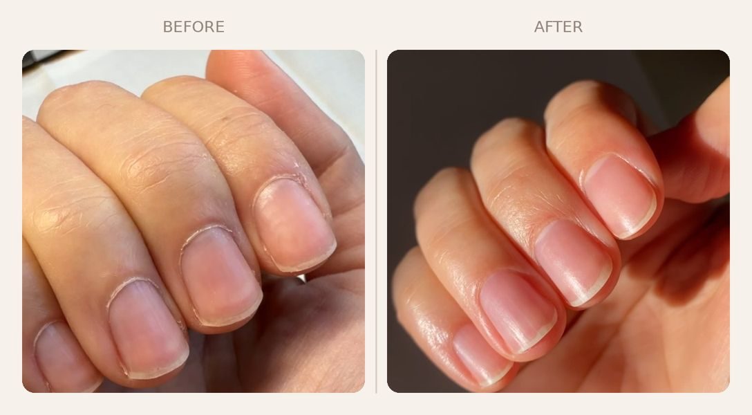 Nägel vor und nach der File Manicure