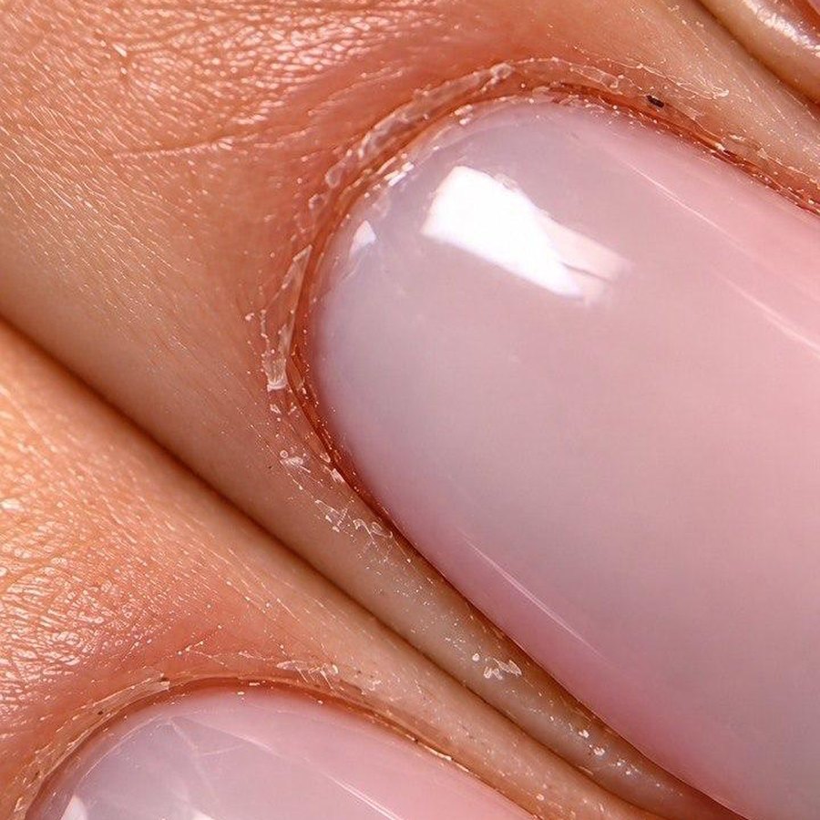 Nahaufnahme: trockene Ränder an der Nagelhaut