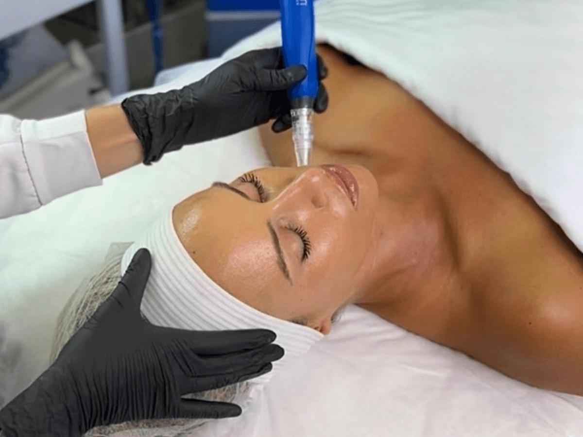 Microneedling & LED light therapy treatments at Fernanda Body Aesthetic