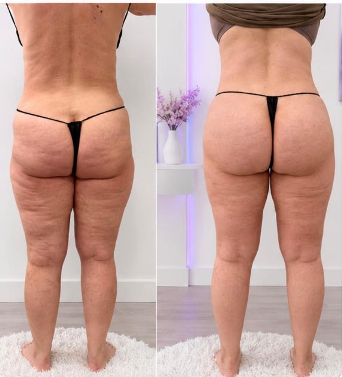 Fernanda Body Aesthetic med spa detail