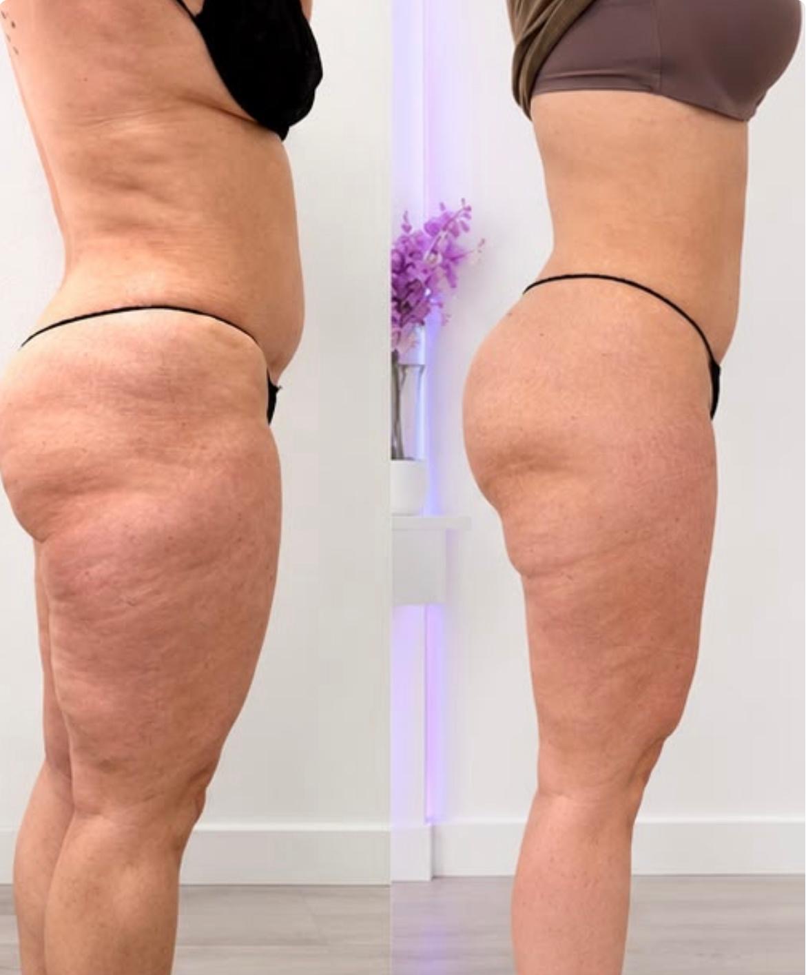Fernanda Body Aesthetic treatment room detail