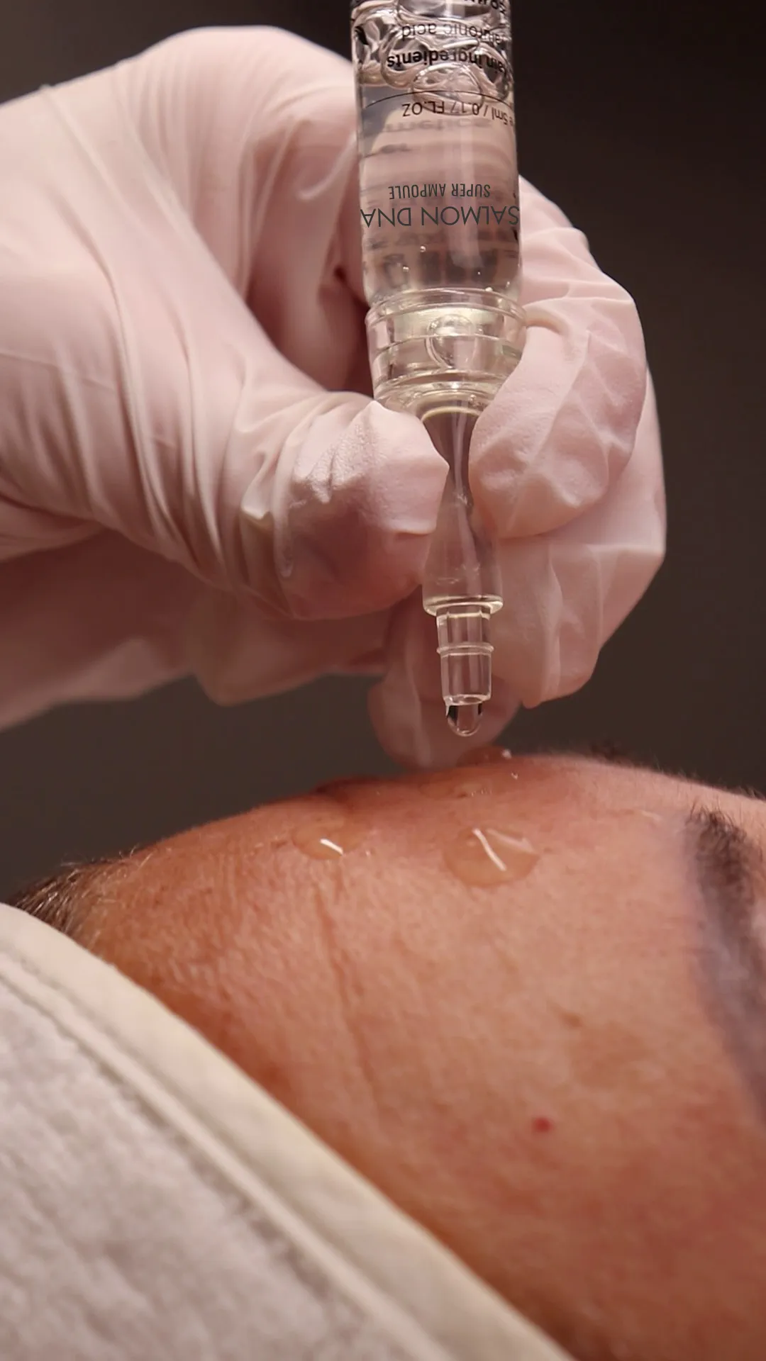 Microneedling-behandling