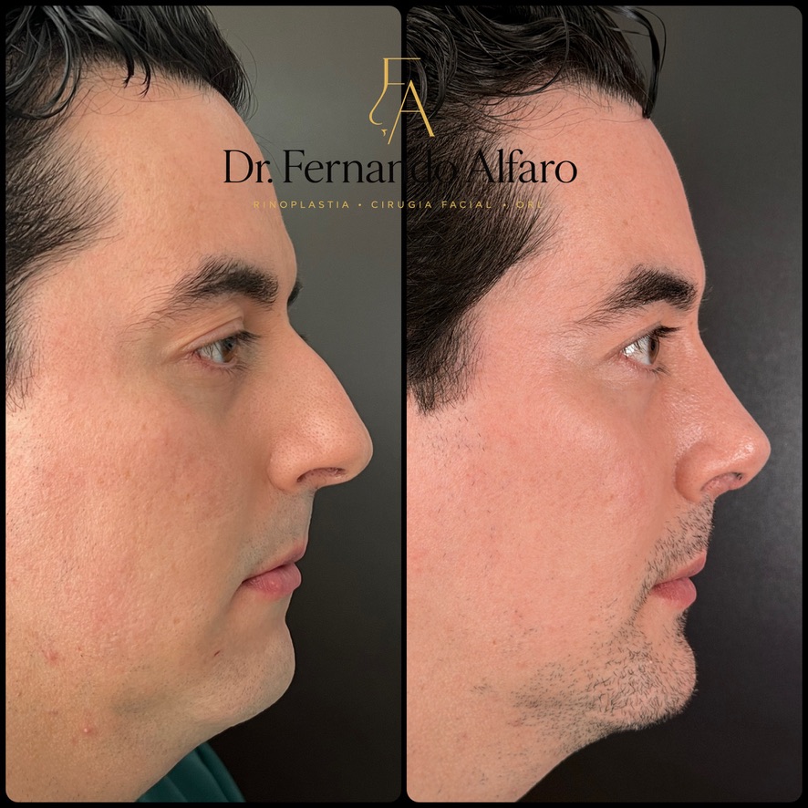 Before & After 4