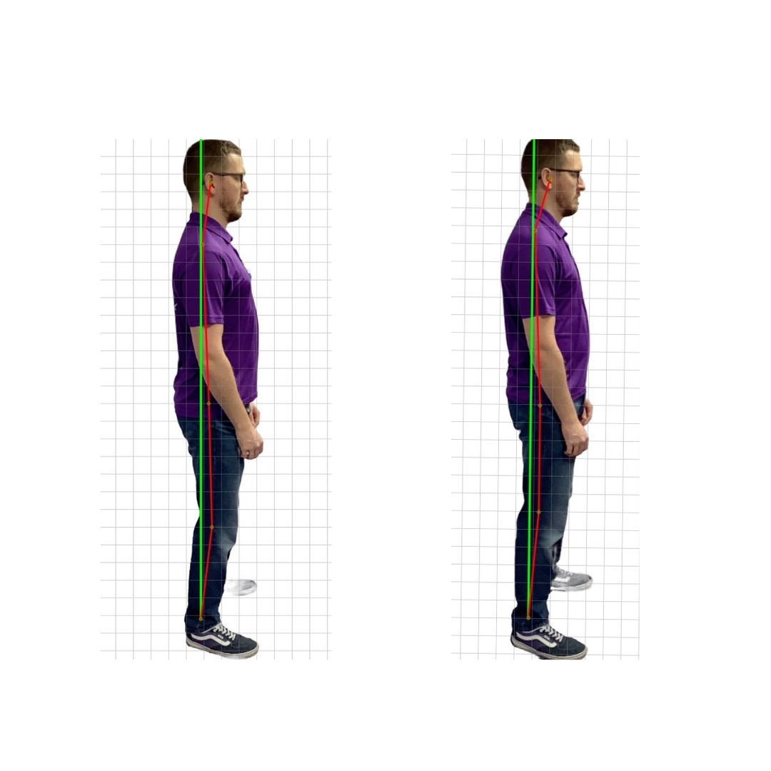 Matt posture picture 