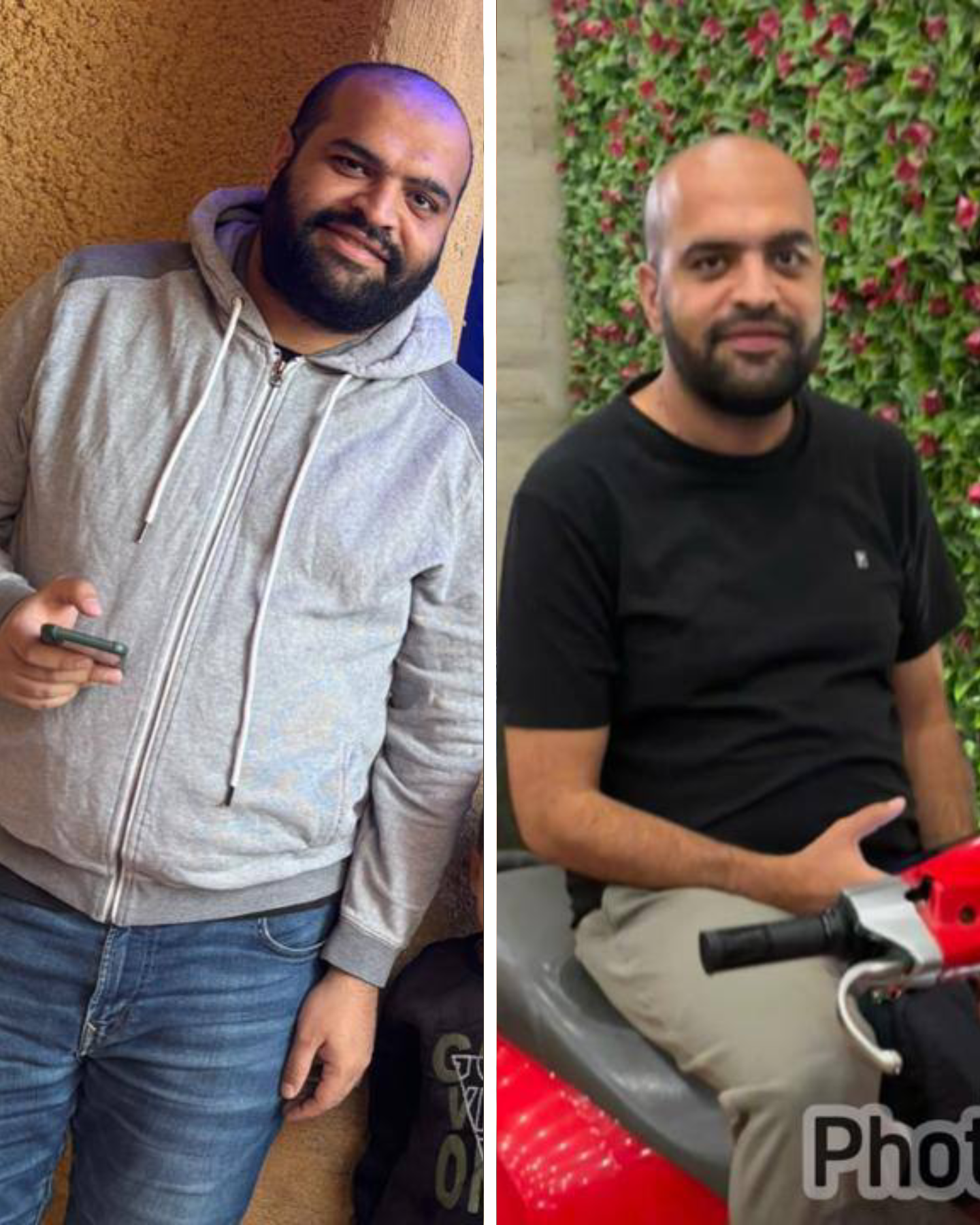 نتيجة رجل - قبل وبعد