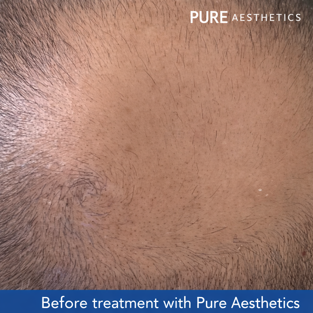 Before scalp treatment