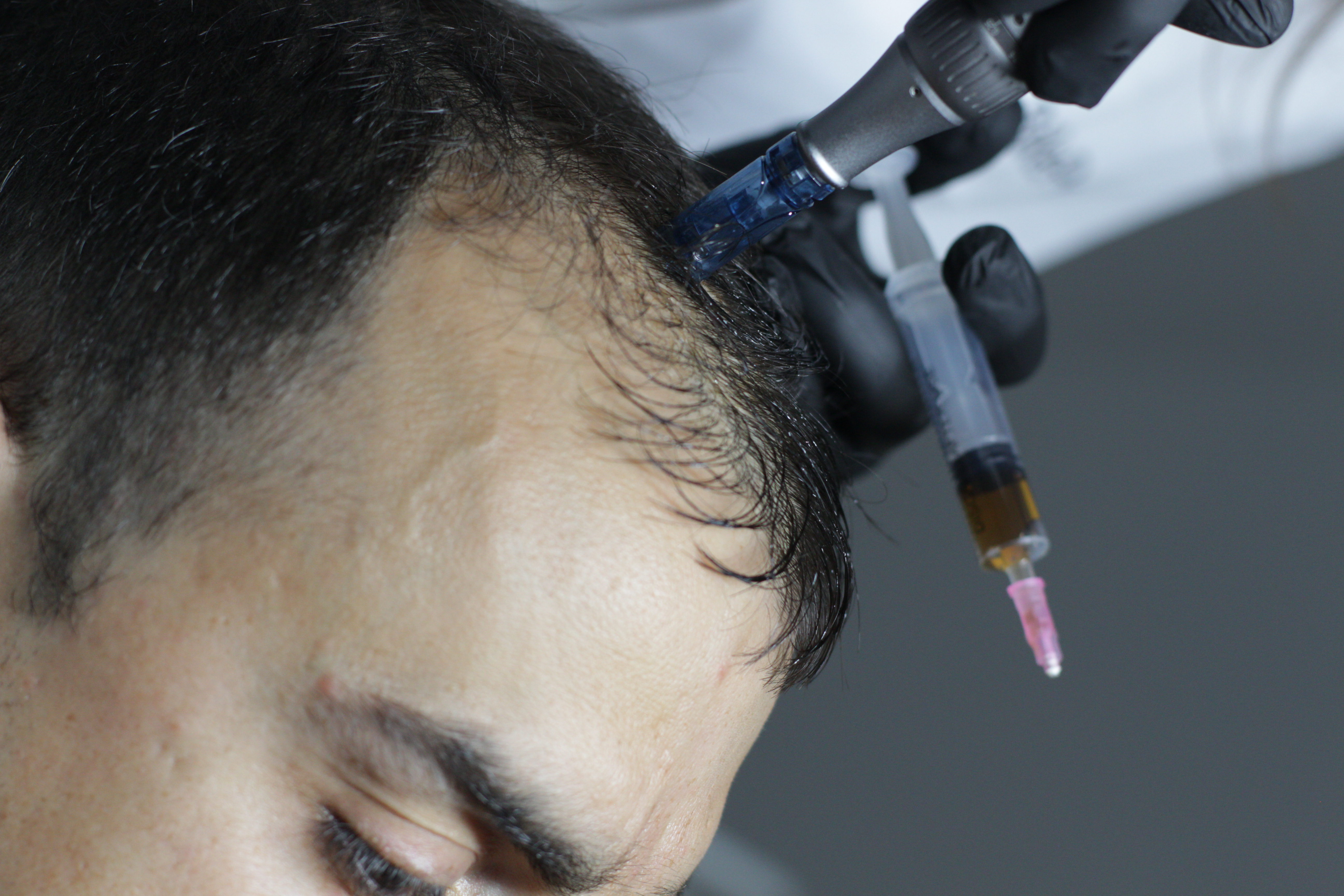 Healthy hair and scalp