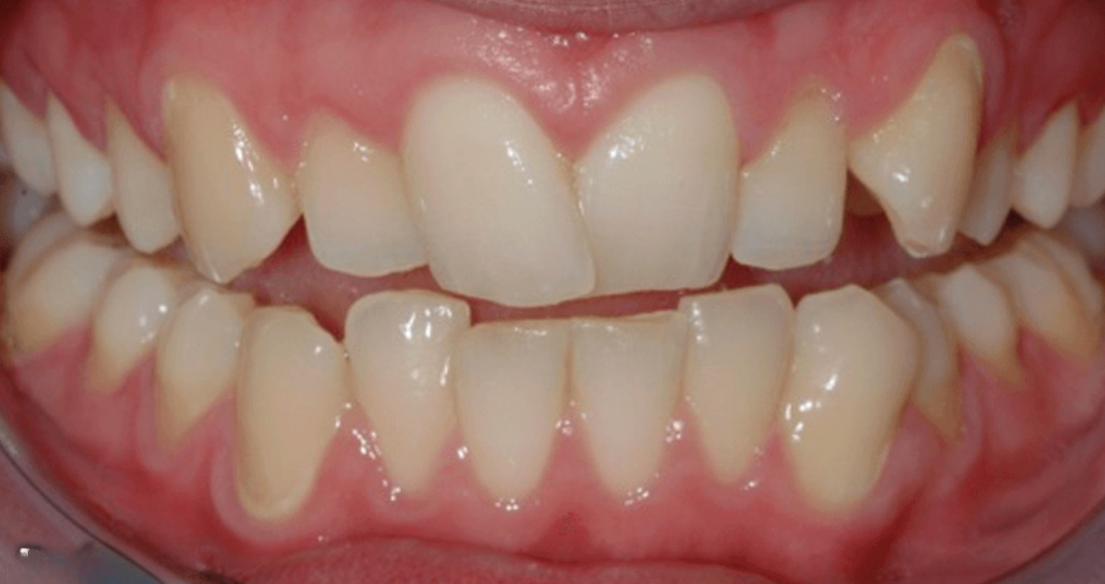 Before treatment