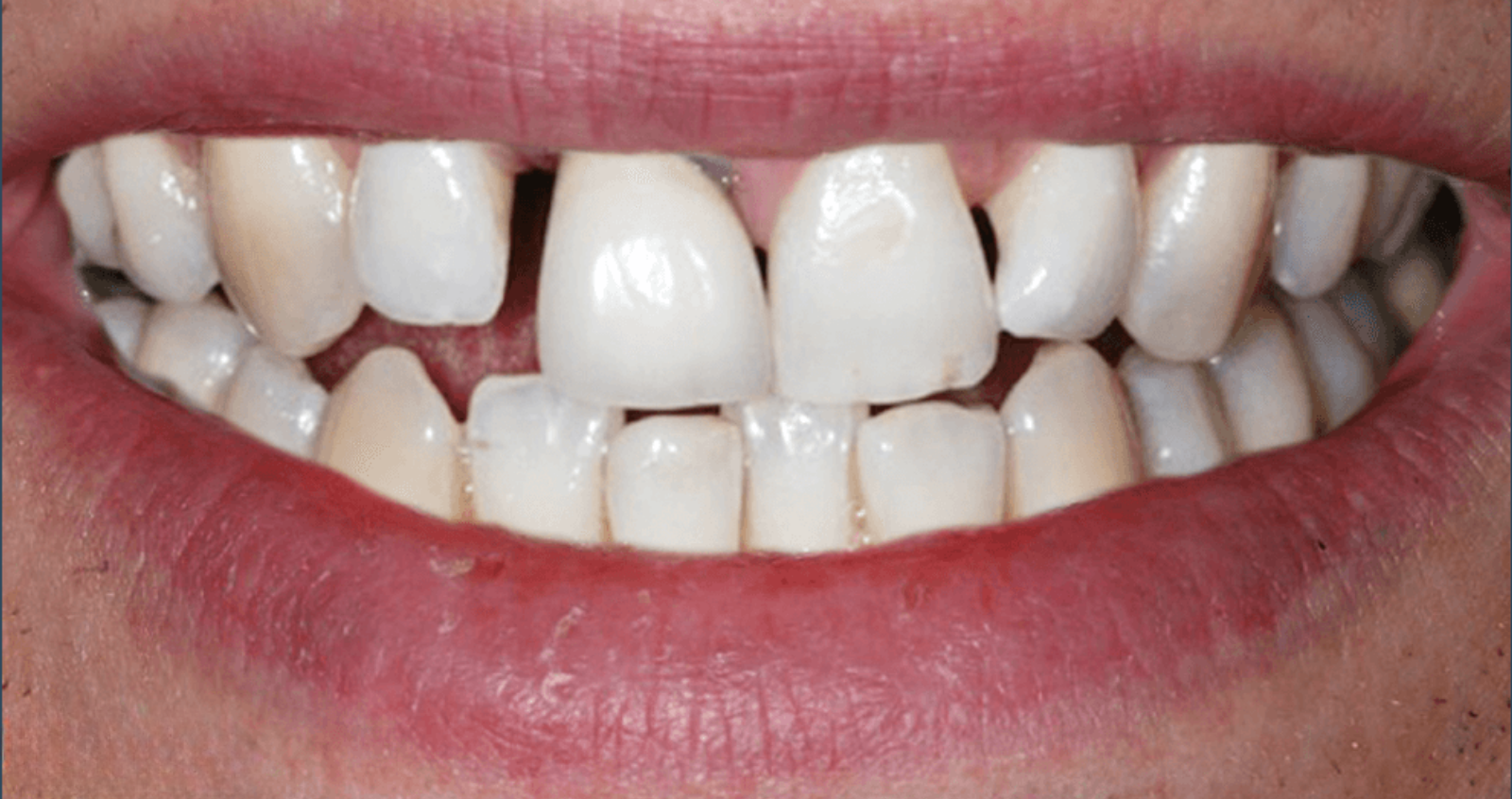 Before treatment