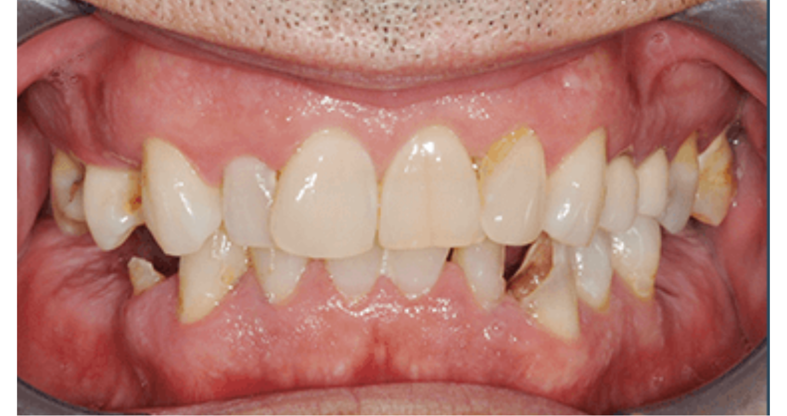Before treatment