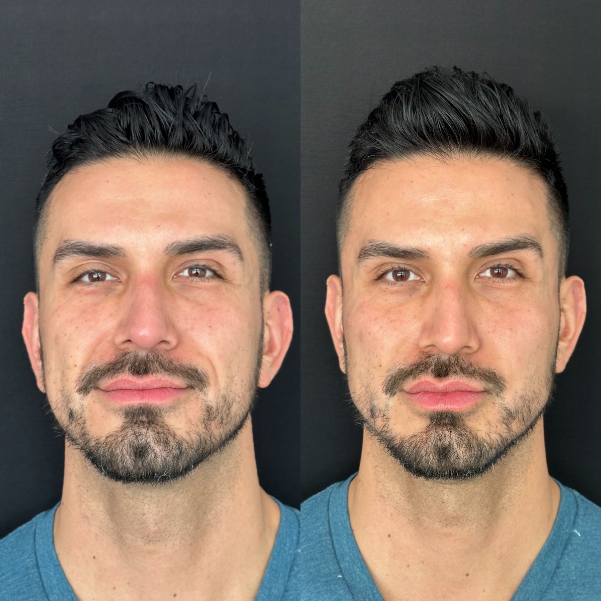 Resultado 1