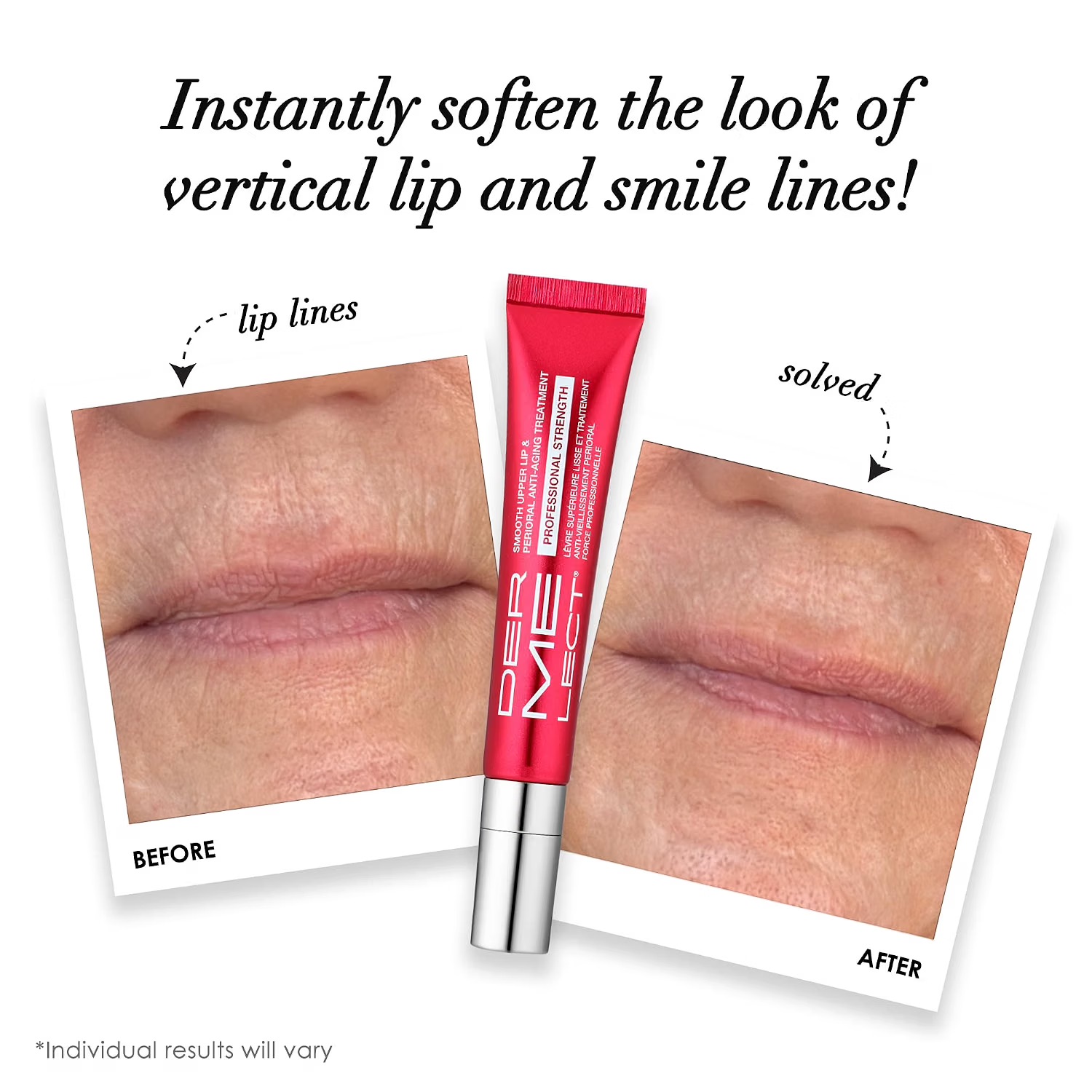 Dermelect Smooth Upper Lip & Perioral Anti-Aging Treatment