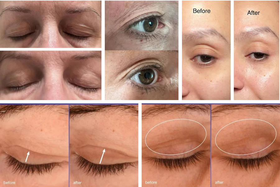 Before and After Photos Before and After Photos