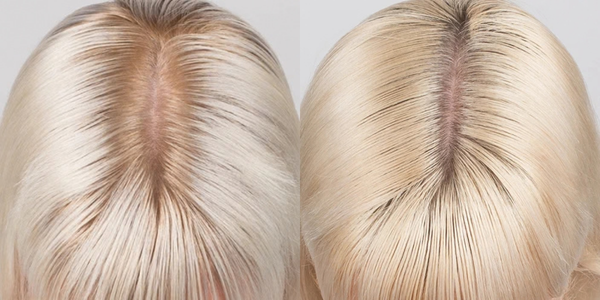 Nulastin Hair Vibrant Scalp Treatment results after 12 weeks Nulastin Hair Vibrant Scalp Treatment results after 12 weeks