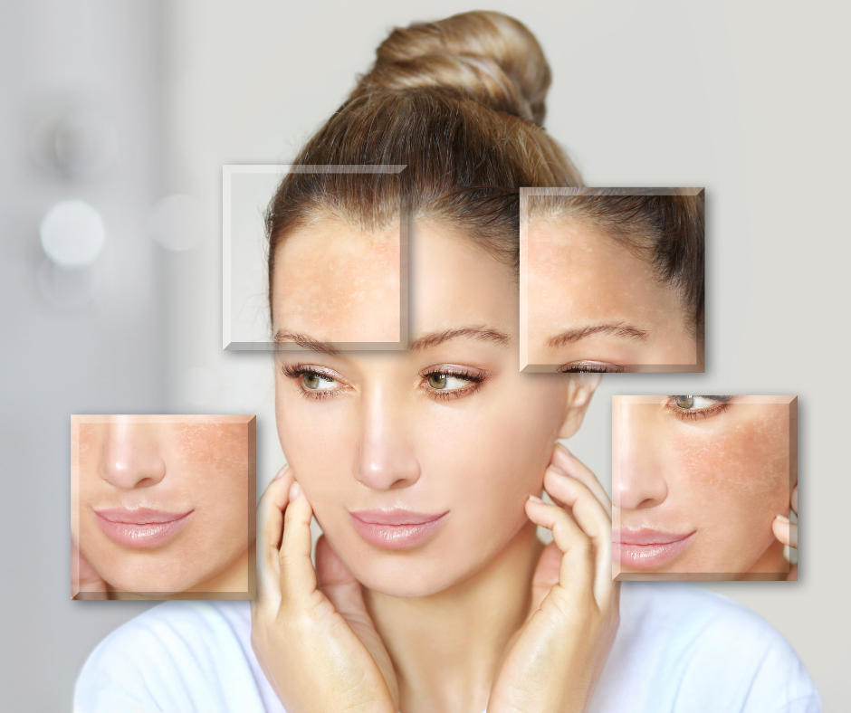 Body treatment areas illustration