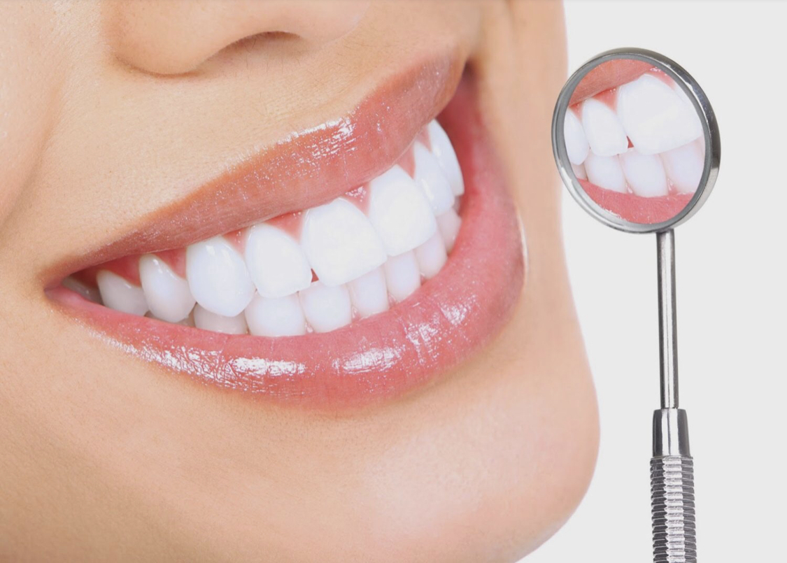 Teeth Whitening