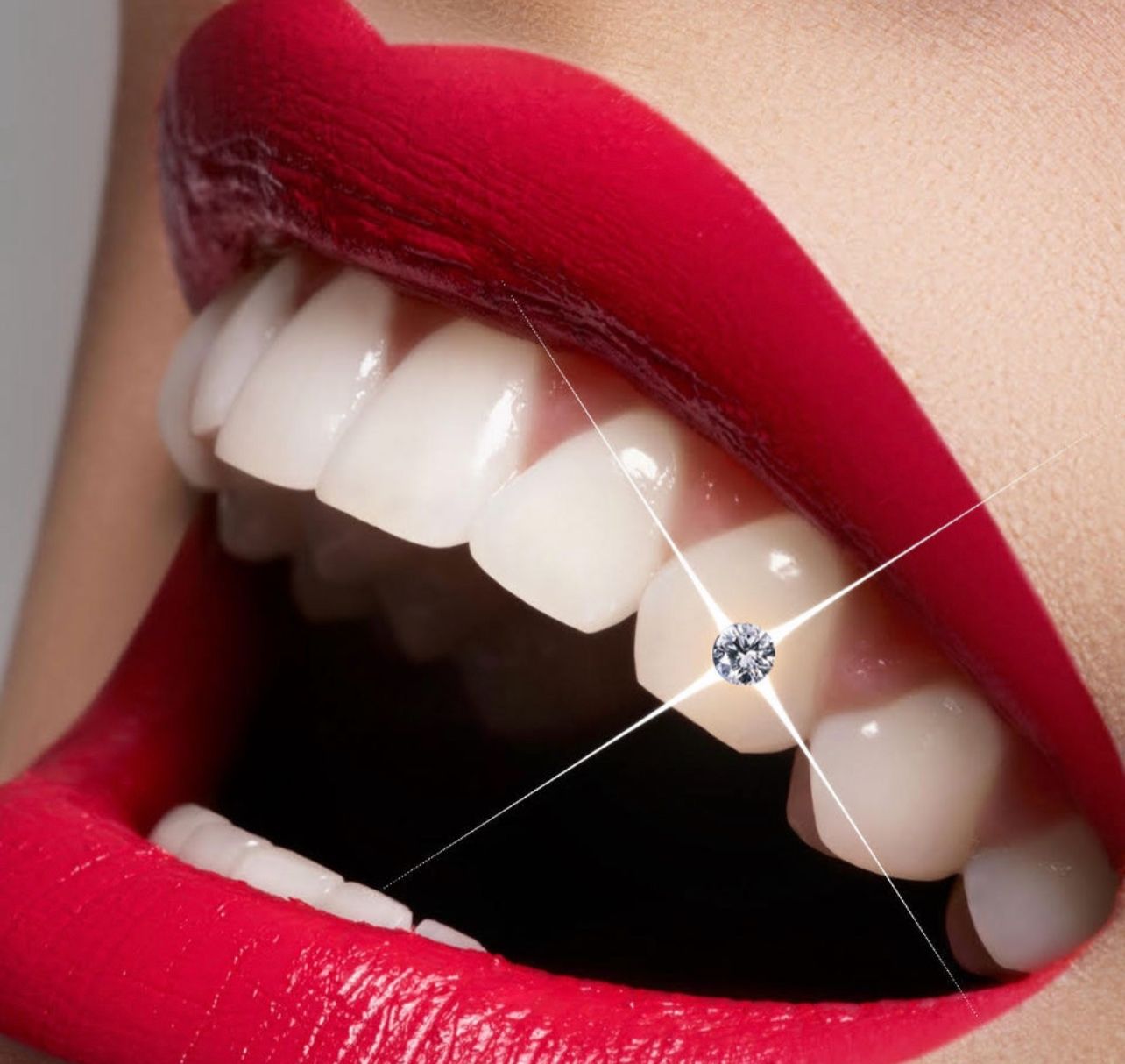 Tooth Gem