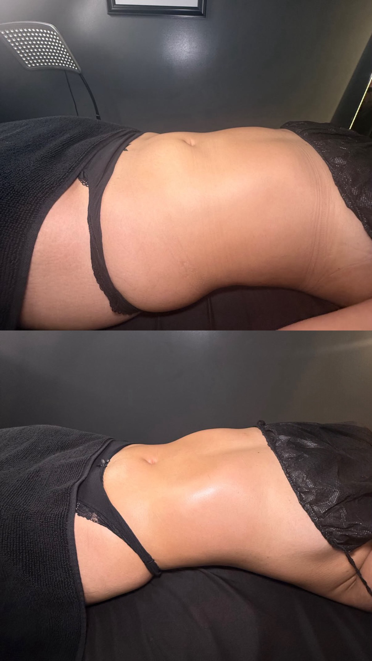 Brazilian Lymphatic Drainage with Colombian Wood Therapy