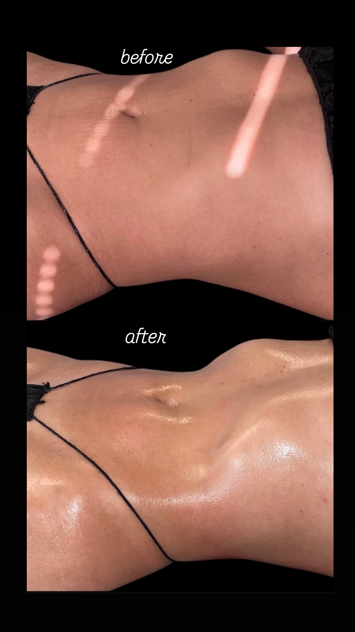 Brazilian Lymphatic Drainage with Colombian Wood Therapy