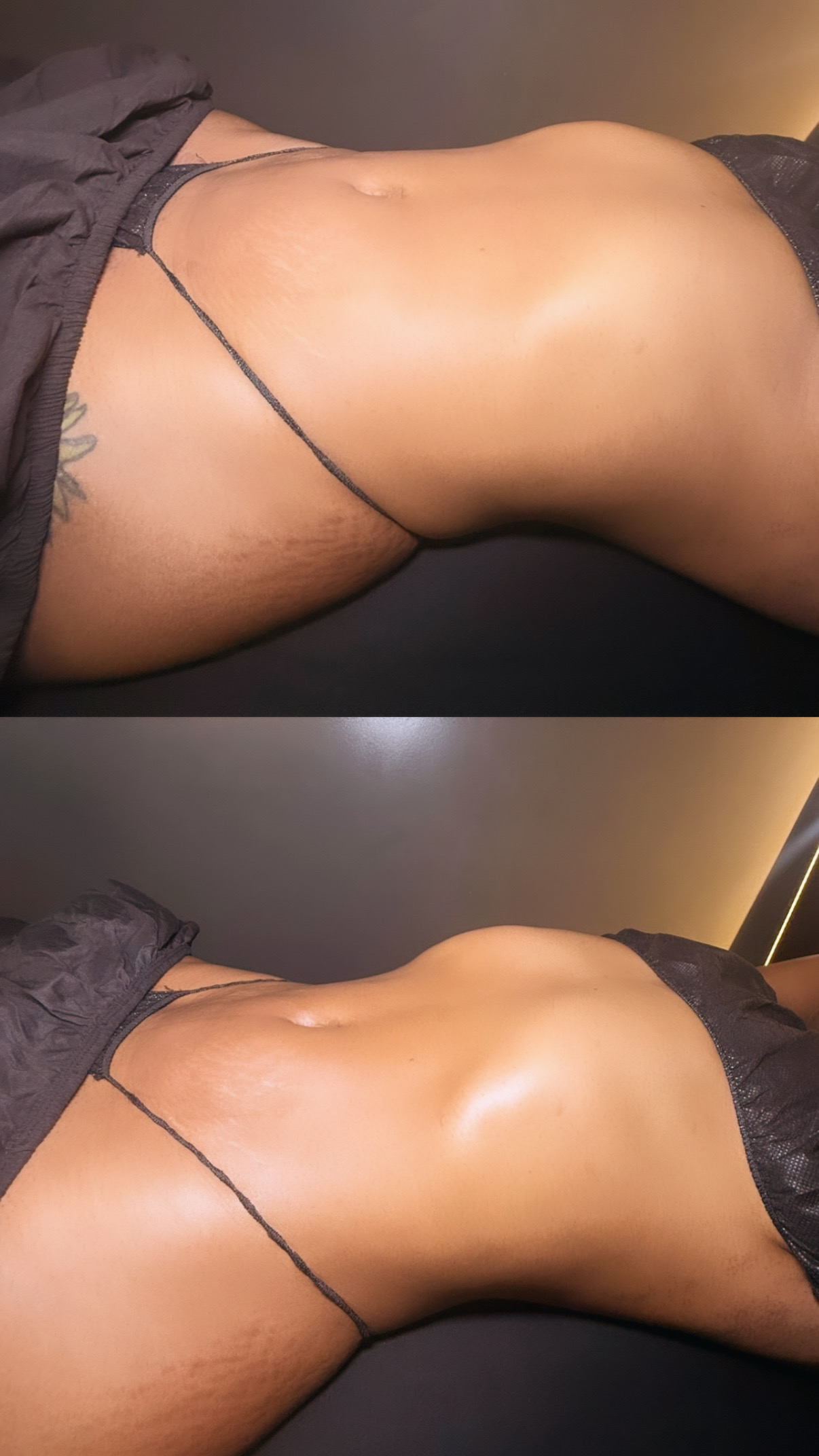 Brazilian Lymphatic Drainage with Colombian Wood Therapy
