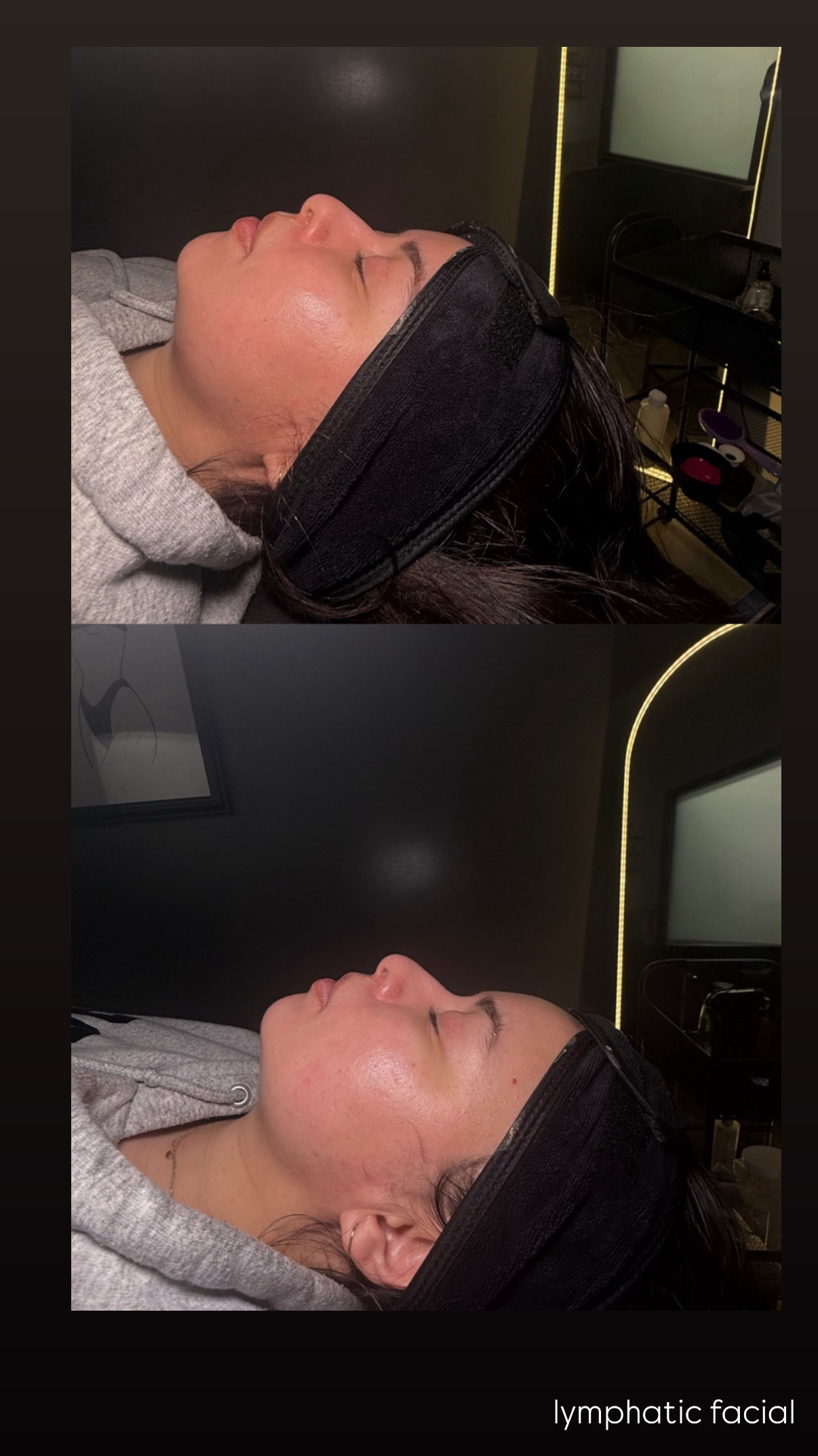 Brazilian Lymphatic Drainage with Colombian Wood Therapy