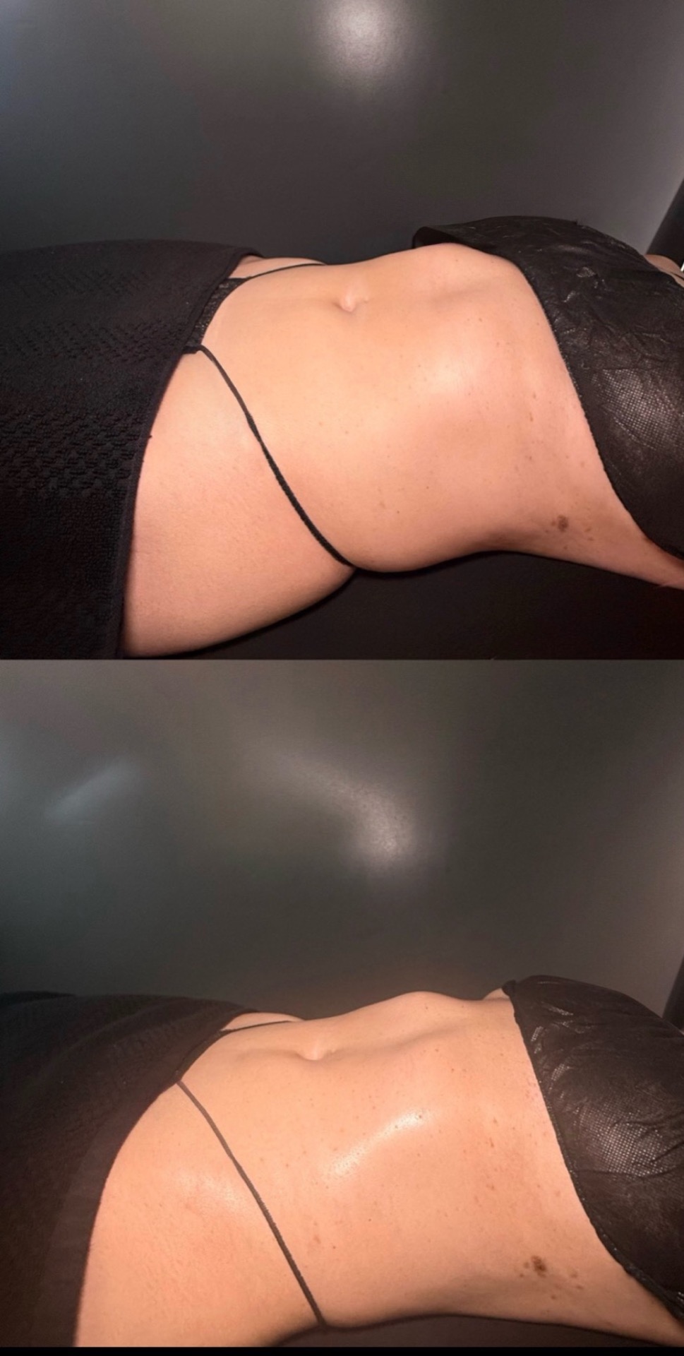 Brazilian Lymphatic Drainage with Colombian Wood Therapy
