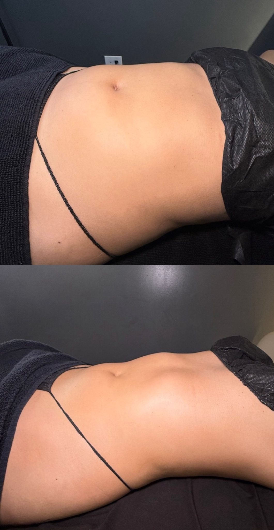 Brazilian Lymphatic Drainage with Colombian Wood Therapy