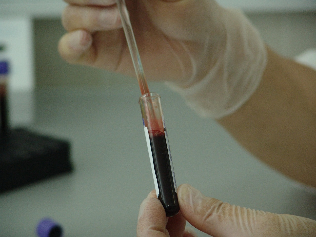 A rack of laboratory test tubes ready for analysis.