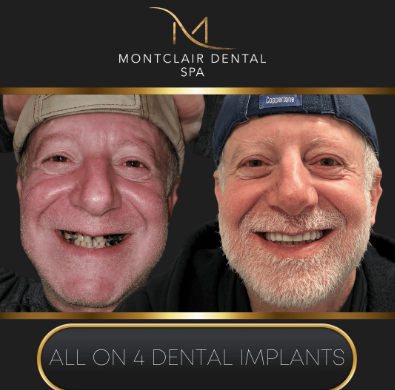Second practice-supplied before-and-after dental photograph