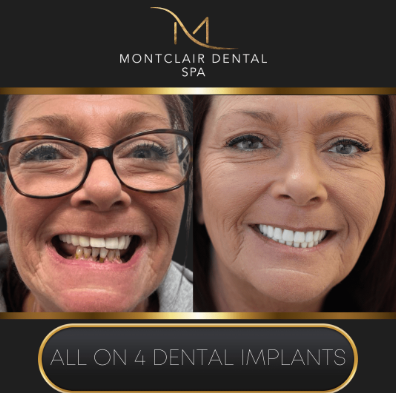 Practice-supplied before-and-after dental photograph