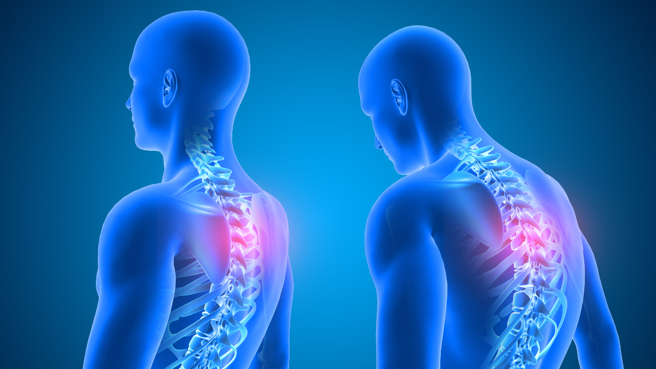 How Chiropractic Care Supports Better Posture Without Constant Reminders | Chiropractor - O'Fallon, MO