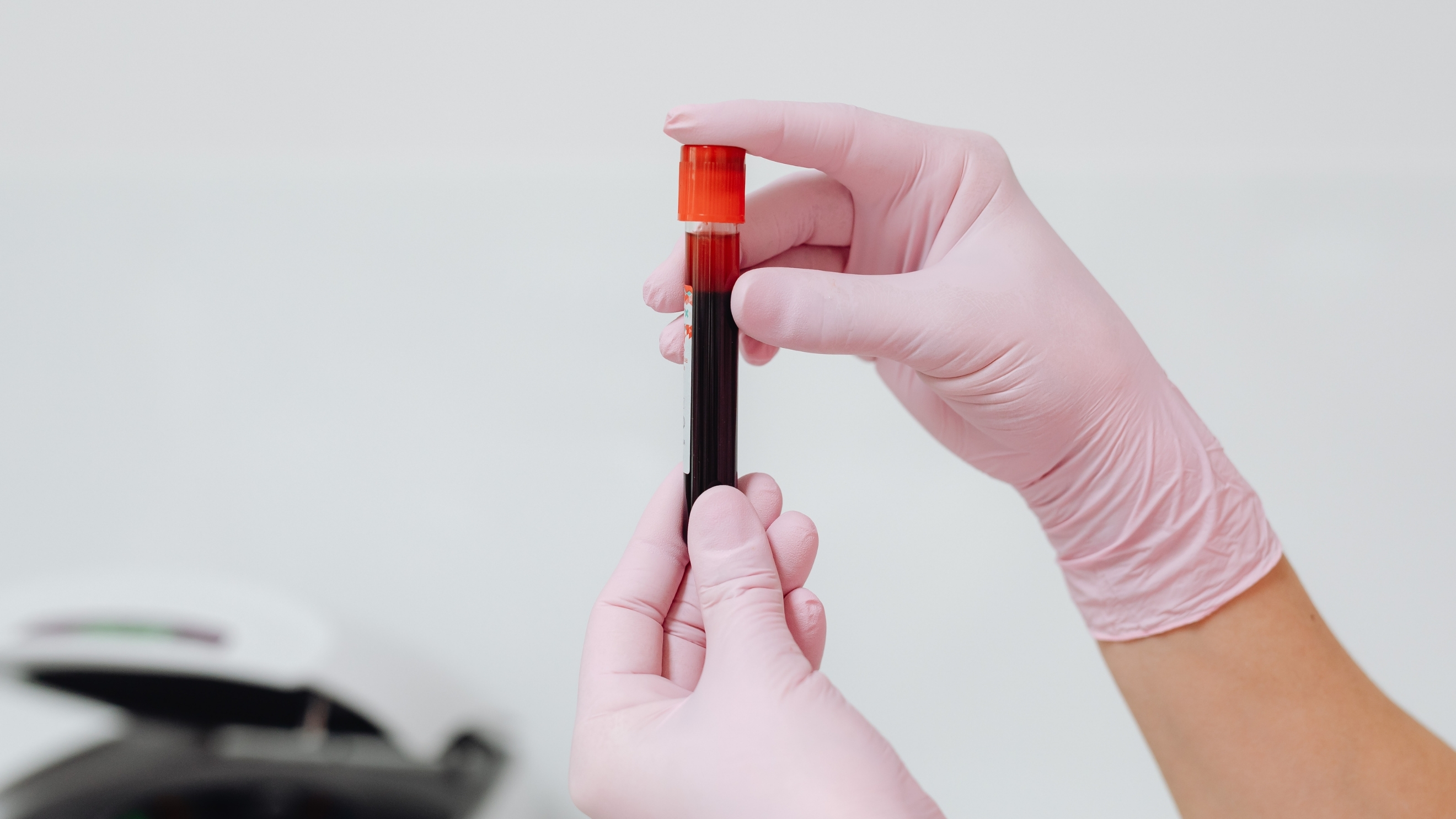 Hormone Testing