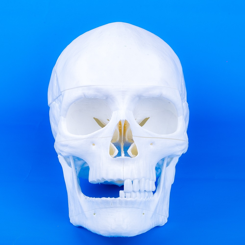 OSCAR human skull