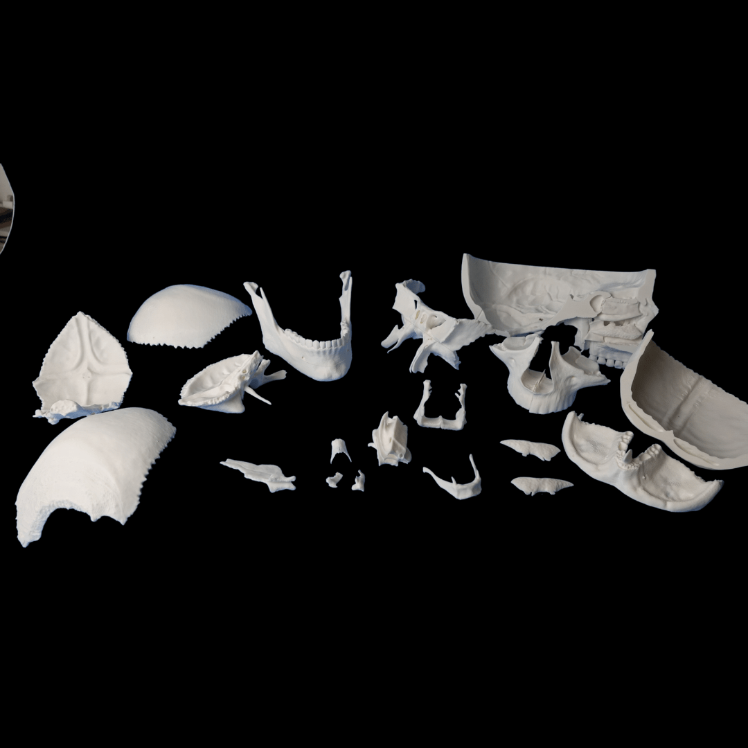 OSCAR — all skull bones separately