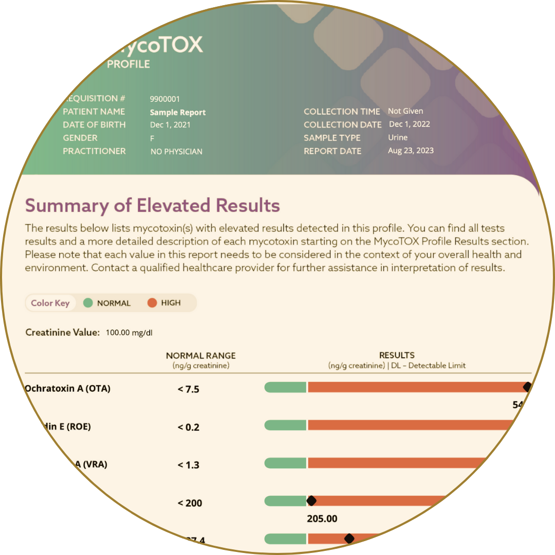 MycoTox profile report summarizing elevated mycotoxin levels detected in urine sample.