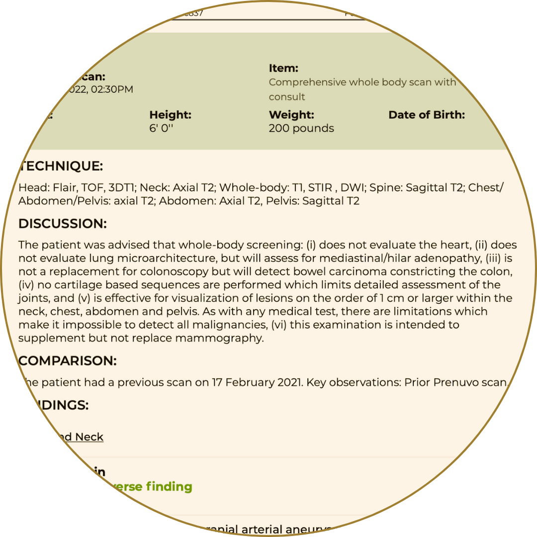 MRI scan report detailing full-body imaging methods, limitations, and diagnostic value for lesions and internal assessment.