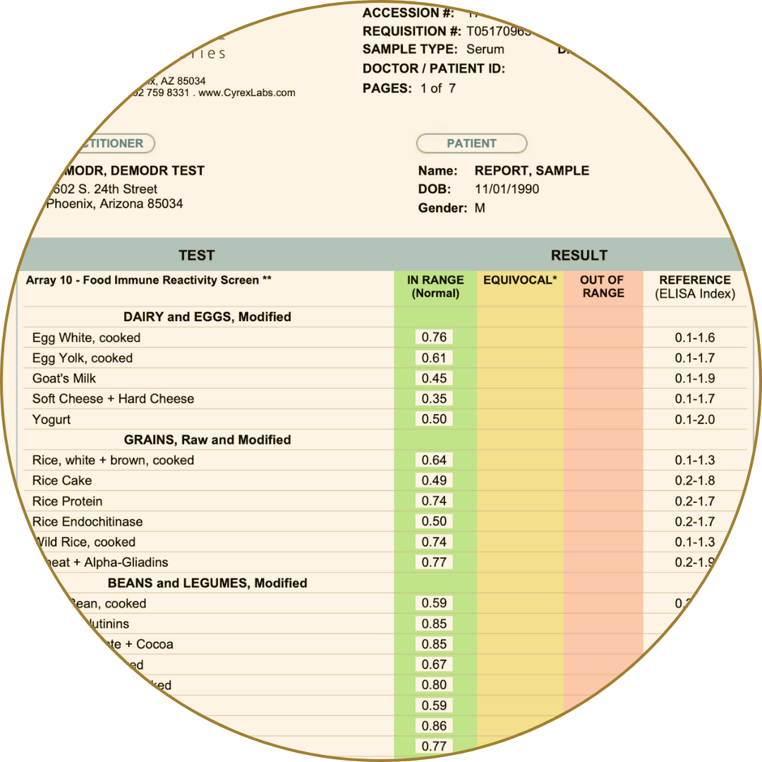 Food immune reactivity screen showing reactions to eggs, grains, legumes, and dairy foods.