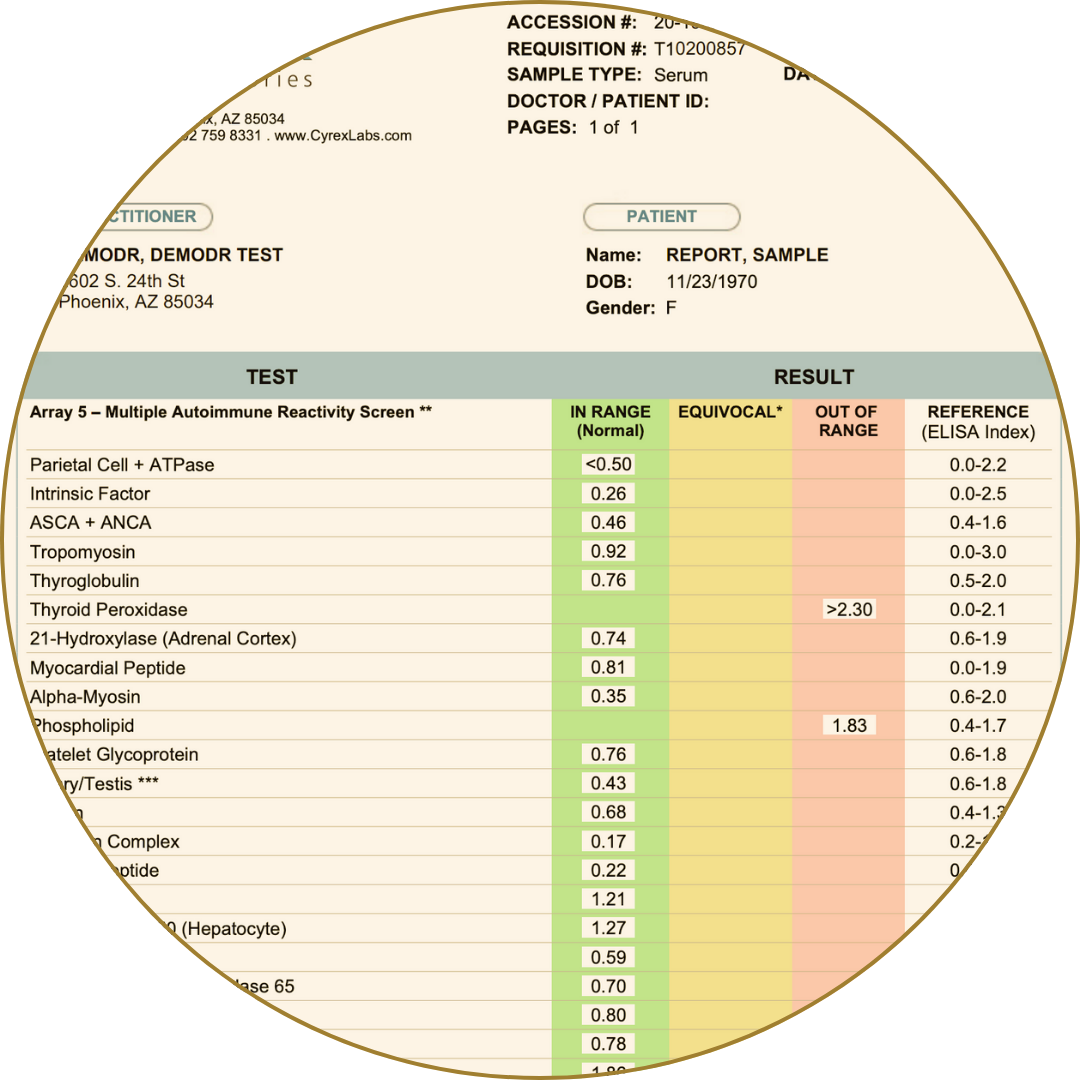 Autoimmune reactivity screen with test results for multiple markers like thyroid and myocardium.