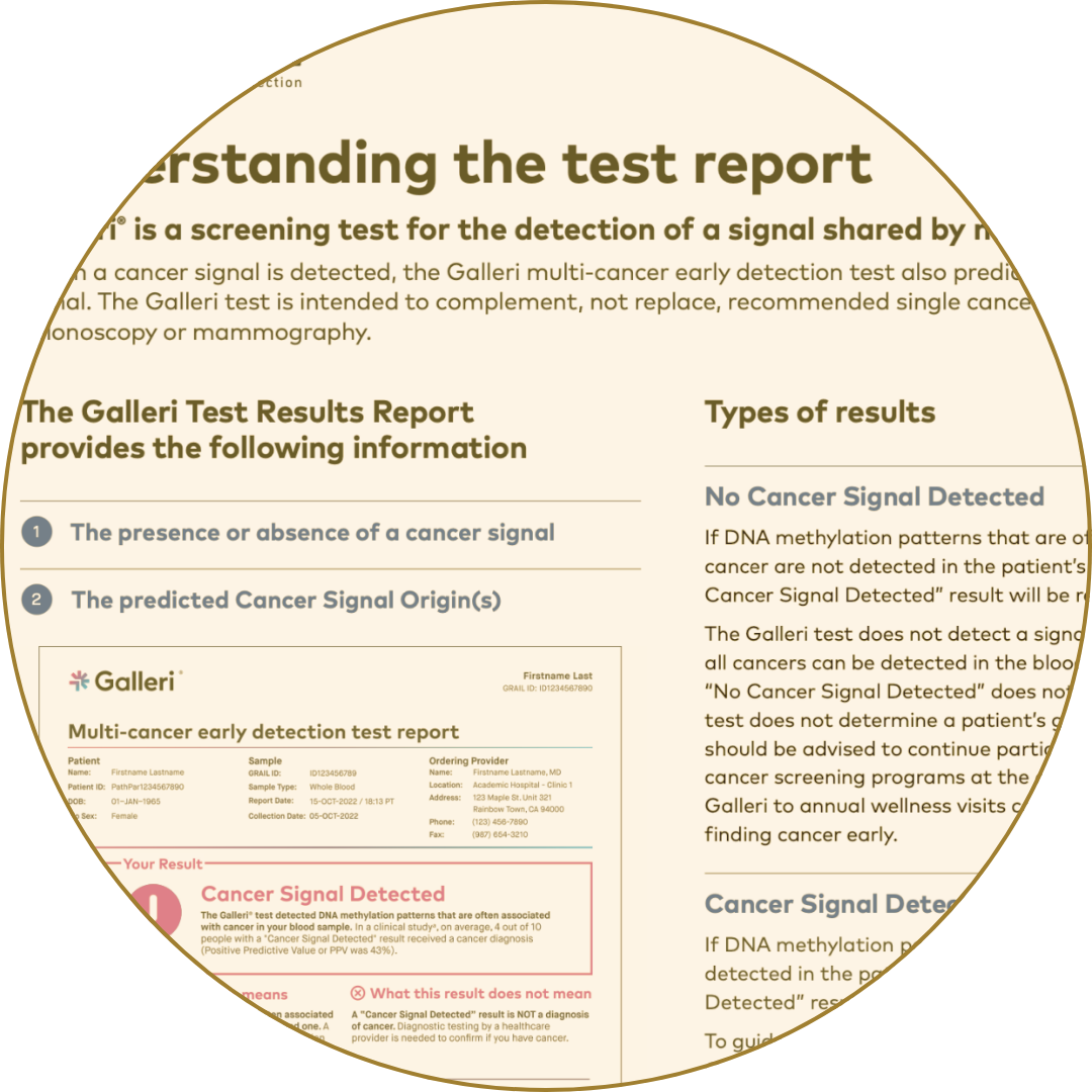 Galleri multi-cancer test report explaining results for cancer signal detection and origin.