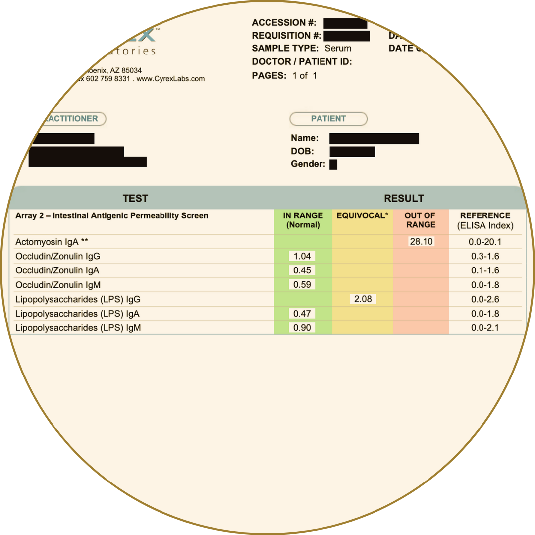Intestinal permeability test results showing markers like zonulin and LPS with color-coded ranges.
