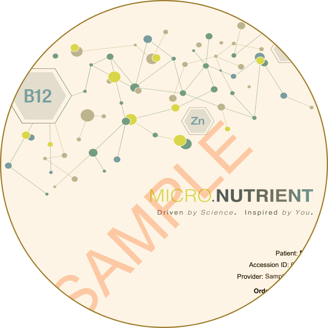 Micronutrient test sample report showing network of elements like B12 and Zinc.