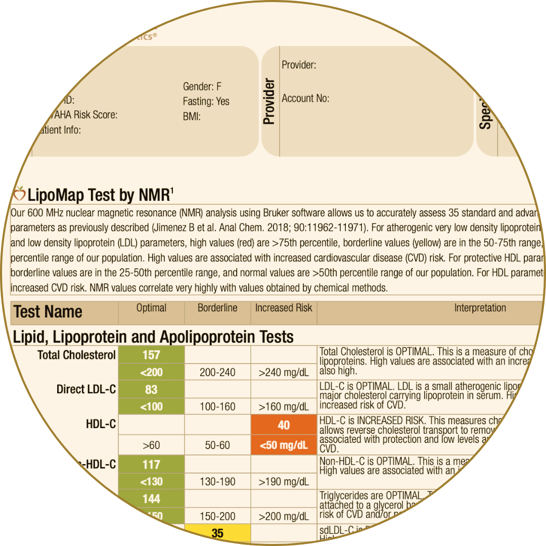 LipoMap NMR lipid test showing cholesterol and apolipoprotein levels with risk interpretation.