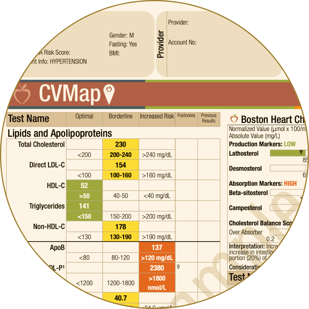 CVMap lipid panel showing cholesterol, LDL, HDL, and ApoB levels with associated risk ranges.