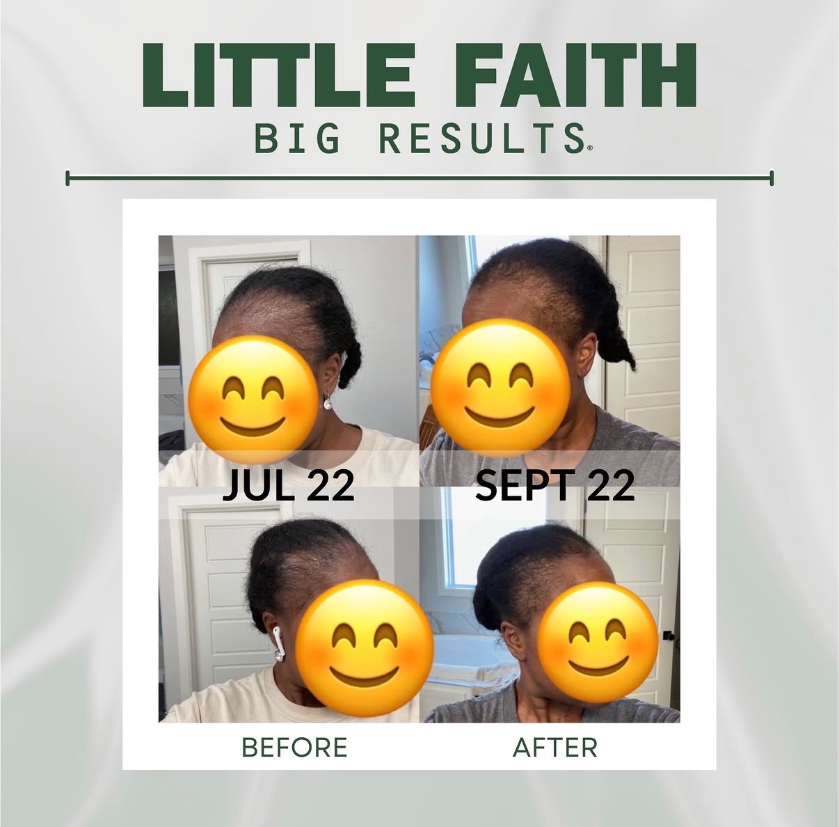Customer alopecia results photo 2